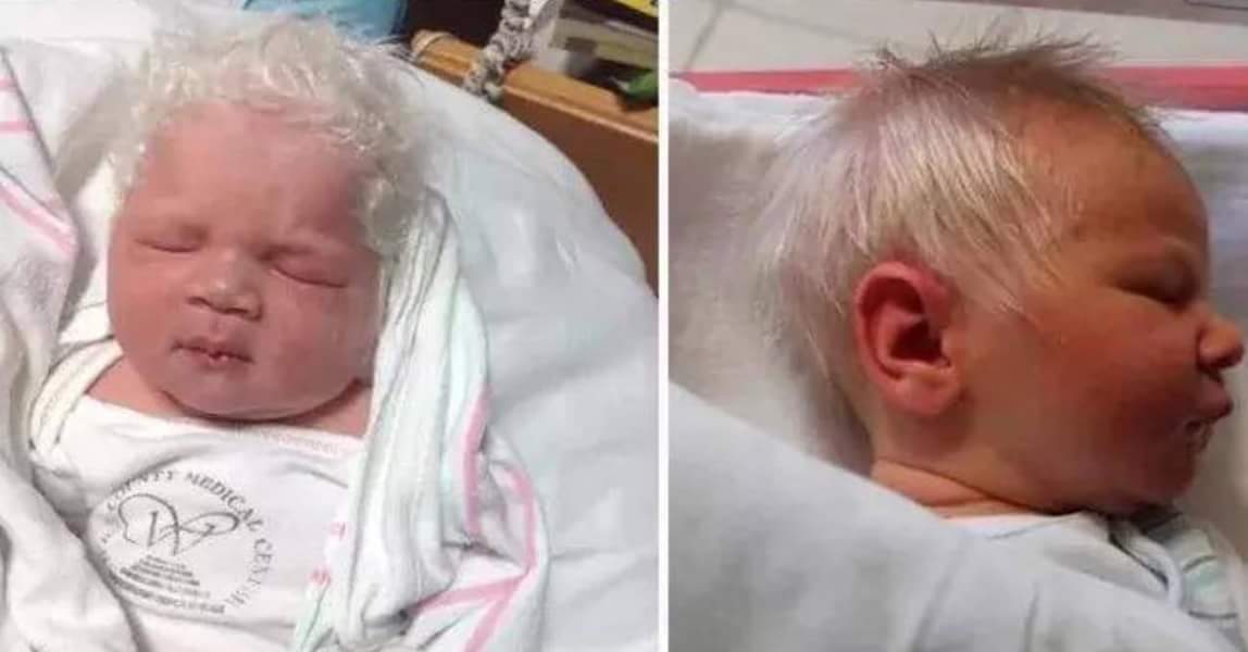 Šis puisēns piedzima ar baltiem matiem. Ārsti nodēvēja viņu par albīnu, bet pavisam drīz atklājās visa patiesība…