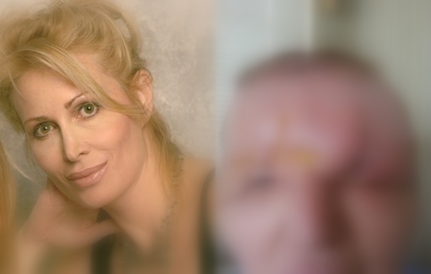 Pēc botoksa injekcijām sieviete pārvērtās par vienacainu briesmoni: šokējošas fotogrāfijas