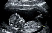 Zinātnieki: nedzimušie bērni sajūt sāpes aborta laikā jau no 12. nedēļas. Bail vien iedomāties… Zinātnieki: nedzimušie bērni sajūt sāpes aborta laikā jau no 12. nedēļas. Bail vien iedomāties…